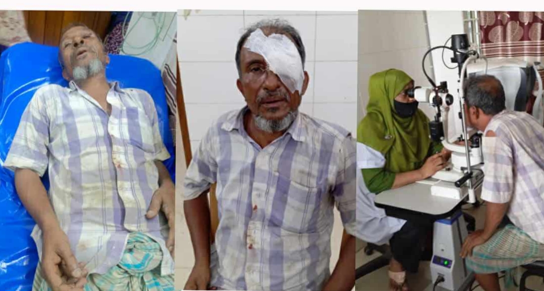 লক্ষ্মীপুরের চন্দ্রগঞ্জে সাংবাদিকের উপর হামলা।